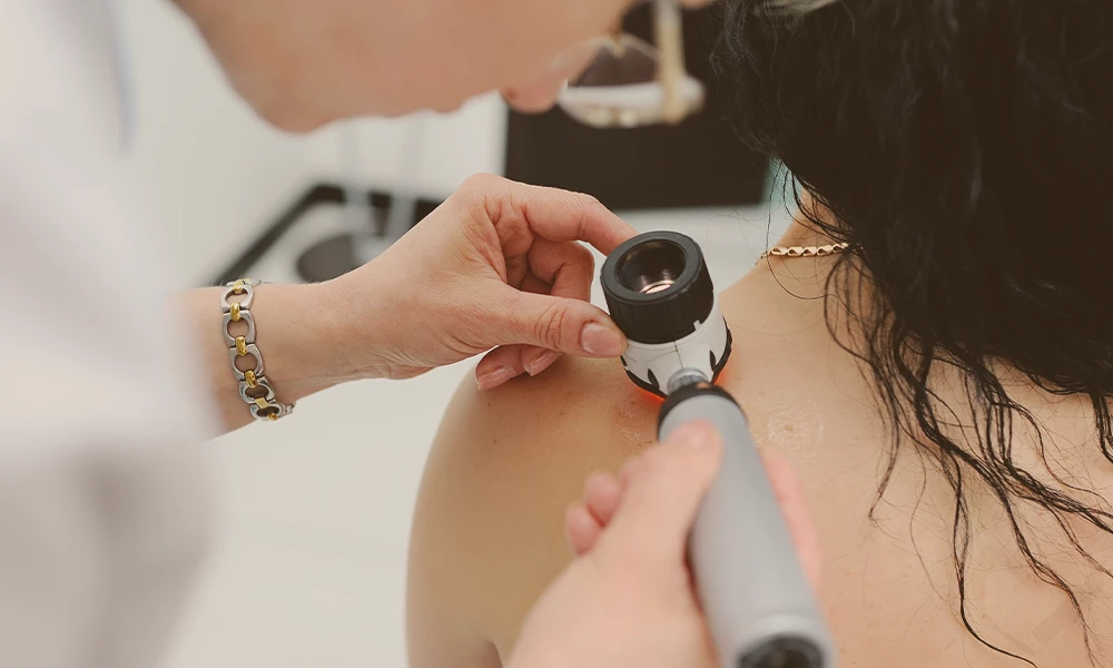 Skin Cancer Clinic